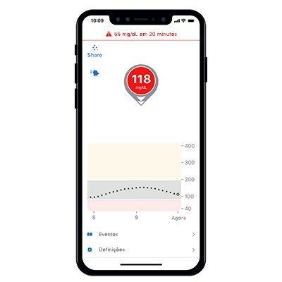 Dexcom G6 CGM alerts provide a 20 minute advance warning